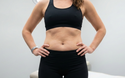 CoolSculpting vs. truSculpt: Which Fat Reduction Treatment Is Right for You?