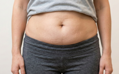 What to Expect During Your First truSculpt Treatment in Ottawa