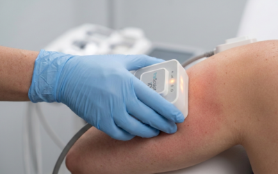 Why Ottawa Residents Are Choosing Non-Surgical Fat Reduction Over Liposuction