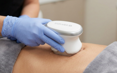 What Is TruSculpt iD? How Ottawa’s Leading Fat Reduction Technology Works